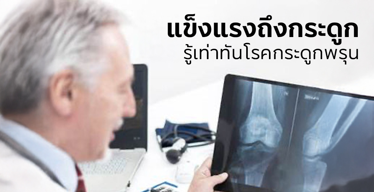 แข็งแรงถึงกระดูก: รู้เท่าทันโรคกระดูกพรุน